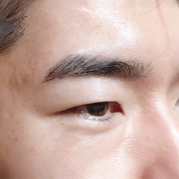 施術後の眉毛